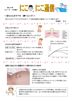 赤ちゃんのでべそ （臍ヘルニア）