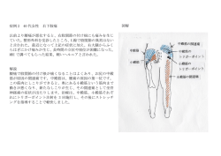 症例 2 40 代女性 右下肢痛 以前より腰痛が悪化すると、右股関節の