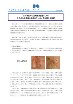 NEWSRELEASE