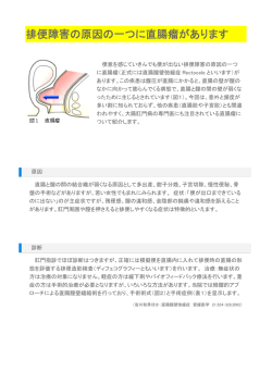 14.排便障害の原因の一つに直腸瘤があります