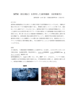 MTM（部分矯正）を併用した歯周補綴 《症例報告》