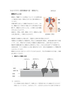 わかりやすい悪性腫瘍の話 膀胱がん 膀胱がんとは
