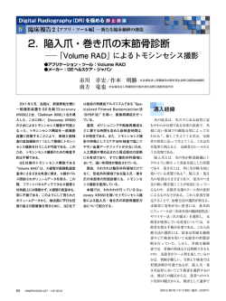 2．陥入爪・巻き爪の末節骨診断  「Volume RAD」