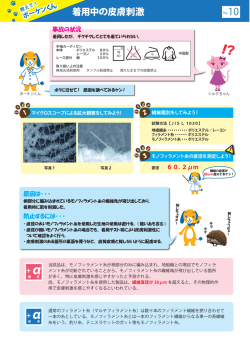 着用中の皮膚刺激