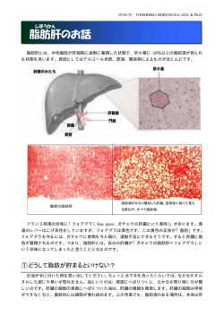 脂肪肝のお話 - 森塚クリニック