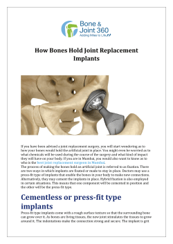 How Bones Hold Joint Replacement Implants