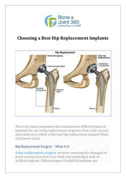 Choosing a Best Hip Replacement Implants