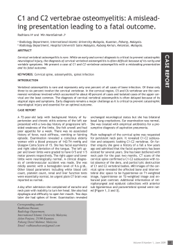 C1 and C2 vertebrae osteomyelitis: A mislead