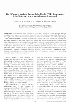 The Efficacy of Variable Intense-Pulsed Light (VPL) Treatment of