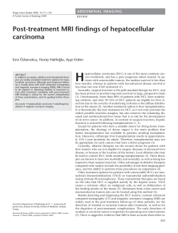 Post-treatment MRI findings of hepatocellular carcinoma