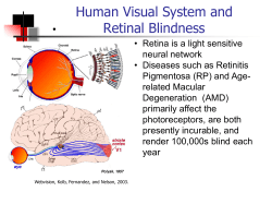 Doheny Eye Institute