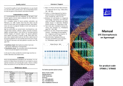 SPE kit on Agarose gel