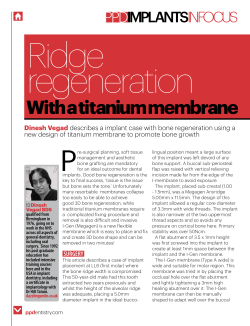 Ridge regeneration With a titanium membrane