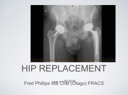 Hip replacement &hellip;.in 2016