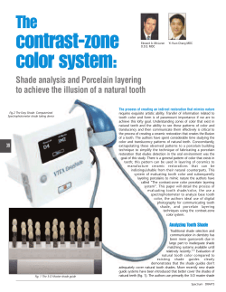 The Contrast-Zone Color System