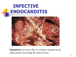 Infective endocarditis