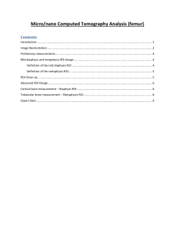 Cortical bone measurement &ndash; Diaphysis ROI