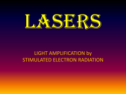 Lasers