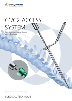 C1/C2 ACCESS SYSTEM