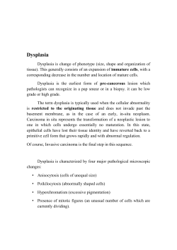 Endometrial hyperplasia