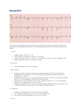 Normal ECG