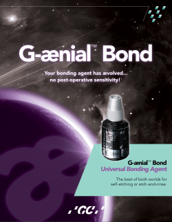 G-&aelig;nial&trade; Bond Universal Bonding Agent