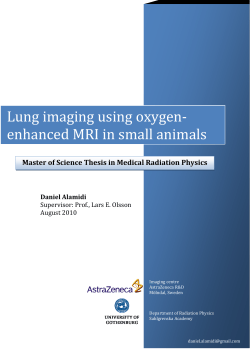 Daniel Alamidi: Lung imaging using oxygen