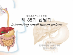 대한소화기내시경학회 제 88회 집담회 Interesting small bowel lesions