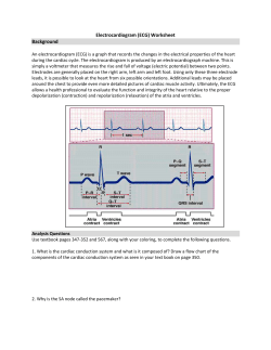 Electrocardiogram (ECG) Worksheet Background An