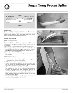 Sugar Tong Precut Splint