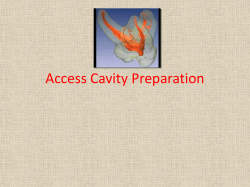 Access Cavity Preparation