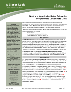 Atrial and Ventricular Rates Below the Programmed Lower Rate Limit