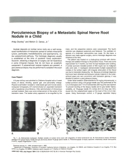 Percutaneous Biopsy of a Metastatic Spinal Nerve Root Nodule in a