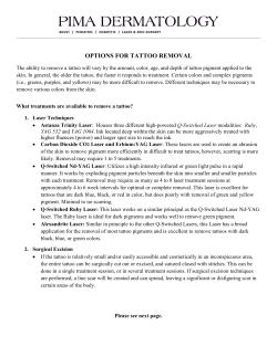 OPTIONS FOR TATTOO REMOVAL