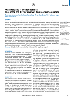 Oral metastasis of uterine carcinoma: Case report and 83