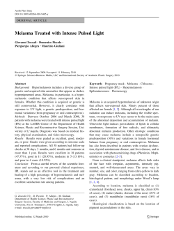 Melasma Treated with Intense Pulsed Light (DEKA