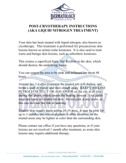 post-cryotherapy instructions (aka liquid nitrogen treatment)