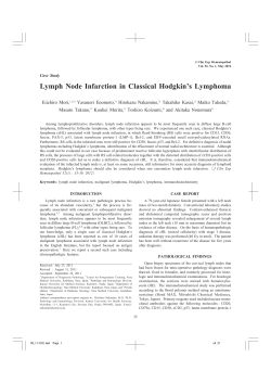 Lymph Node Infarction in Classical Hodgkin`s Lymphoma - J