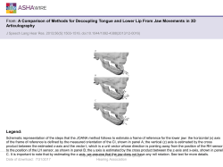 A Comparison of Methods for Decoupling Tongue and Lower Lip