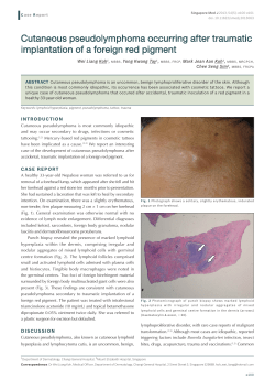 Cutaneous pseudolymphoma occurring after