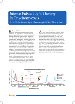 Intense Pulsed Light Therapy in Onychomycosis