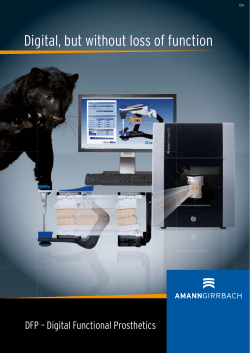 Digital, but without loss of function