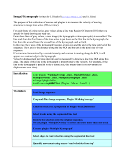 ImageJ Kymograph Makro