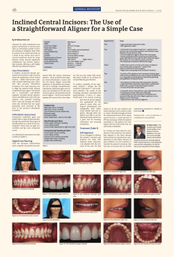 Inclined Central Incisors: The Use of a Straightforward Aligner for a