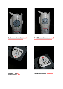 The CD Oxygen cylinder valve is closed The CD Oxygen cylinder