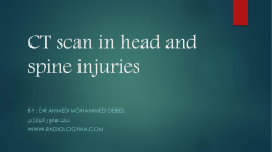 CT scan in head and spine injuries