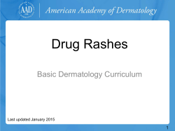 Drug Rashes - American Academy of Dermatology