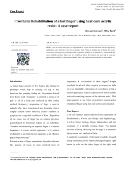 Prosthetic Rehabilitation of a lost finger using heat cure