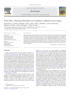 Active fibers: Matching deformable tract templates to diffusion tensor
