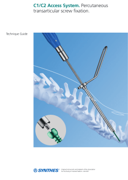 C1/C2 Access System. Percutaneous transarticular screw fixation.
